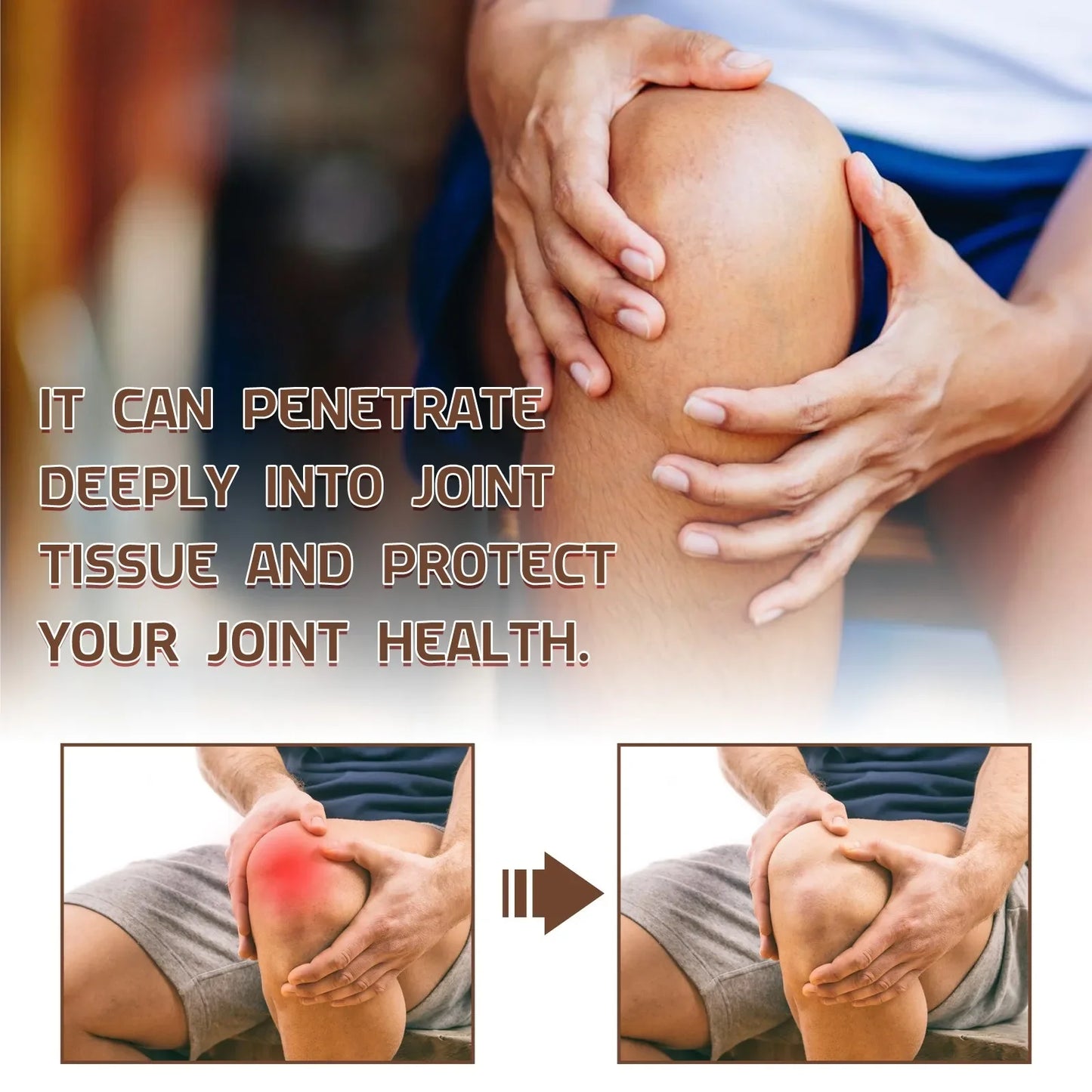 Bee Spray, Bee Joint Spray, Bee Spray, Bee Pain And B One Spray-20ml Daily Maintenance Travel Essentials Fashion 2024